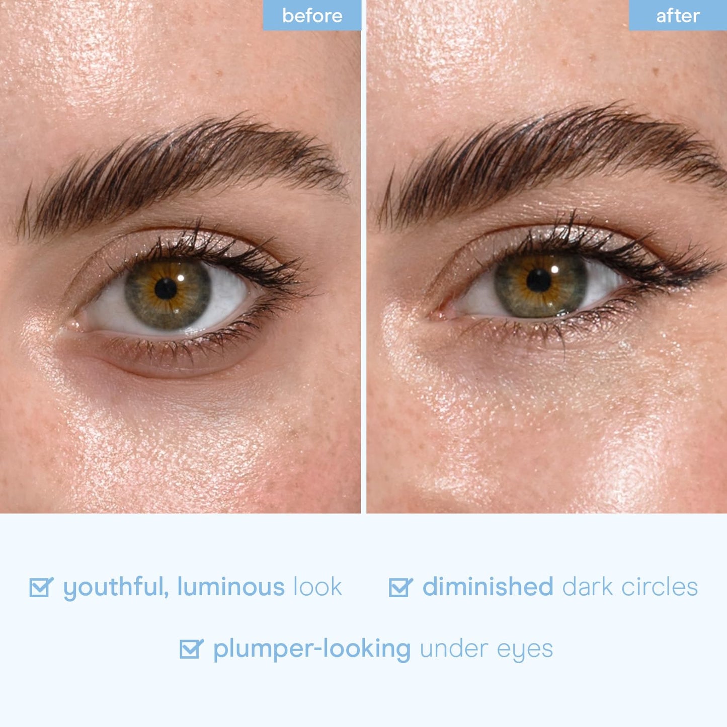 Baebody Advanced Snail Mucin Under Eye Patches for Women & Men (6 Pairs) - Under Eye Masks for Dark Circles and Puffiness - With Niacinamide - Reduce Fine Lines and Wrinkles